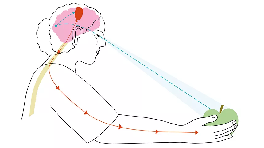 https://blog.ophtalmique.ch/app/uploads/2023/04/Infographie.jpg